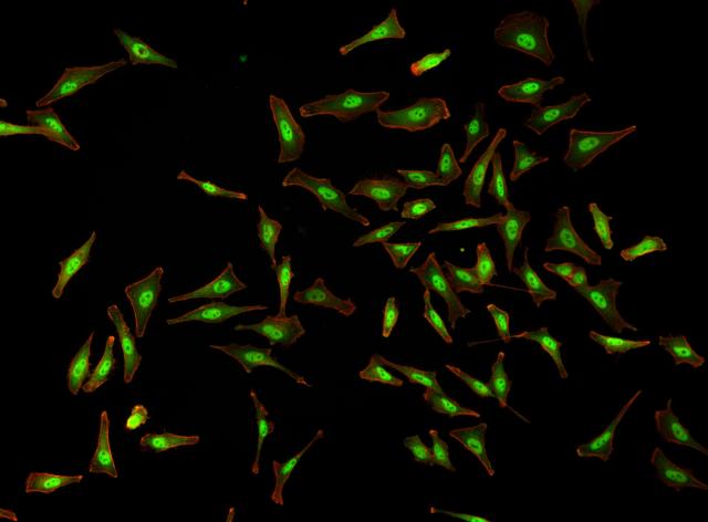 Analyse au microscope
