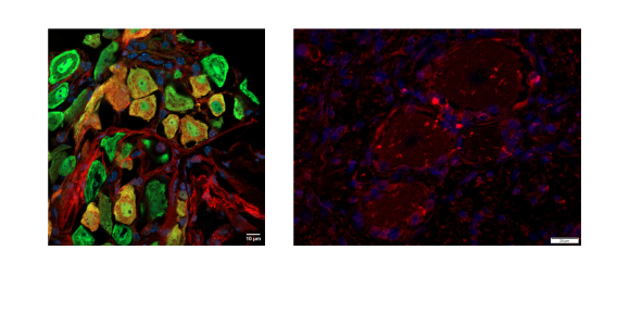 Ganglions de souris (à gauche) et humains (à droite)